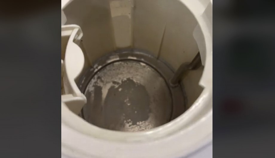 RECITE ZBOGOM KAMENCU U KUVALU Uklonite ga ovom prirodnom mešavinom koja čini čuda