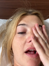 OVAKO SE NAJBOLJE LEČI MAMURLUK Doktorka otkrila najefikasnija rešenja za jutro posle praznika