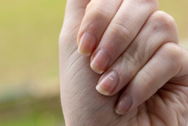 PROVERITE DA LI "TIHI UBICA" VREBA NA VAŠIM NOKTIMA  Ove promene mogu ukazivati na opasnost, a evo o kakvom oboljenju je reč