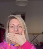 PEVAČICA SVA U MODRICAMA! Javnost zabrinuta, otkrila šta joj se dogodilo, ljudi u šoku kada su joj videli lice! (FOTO)