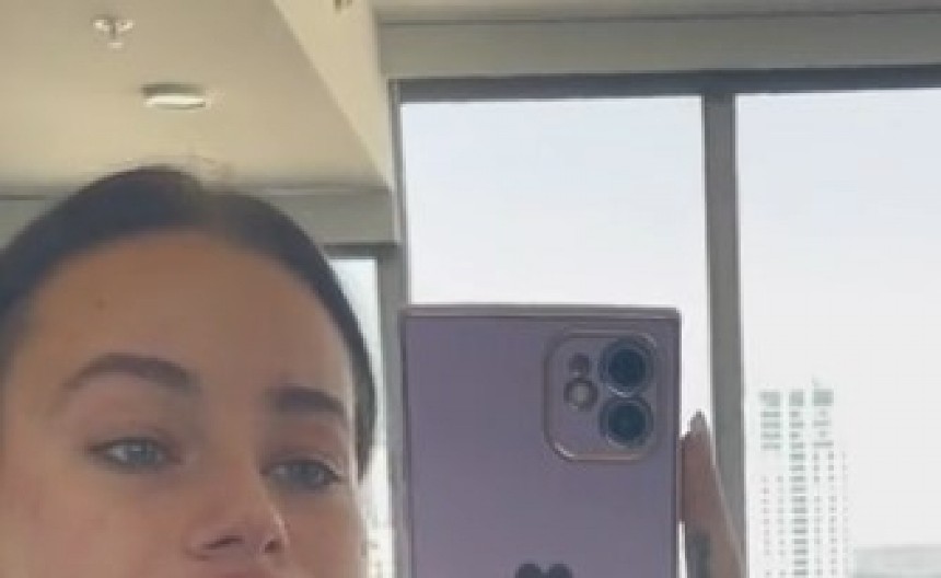 AU, ŠTA URADI TO OD SEBE, CRNA DEVOJKO? Osvojila besplatno povećanje usana na instagramu, usledio horor - potpuno se deformisala! (VIDEO)