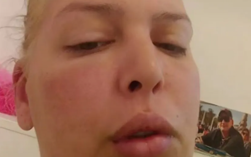 AVA KARABATIĆ POTPUNO IZOBLIČENA! Procurila stravična fotka, svi zabrinuti za njeno stanje, završila na lečenju!