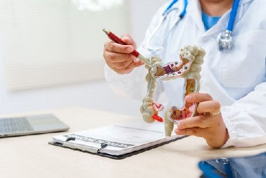 GASTROENTEROLOG OVE 3 NAMIRNICE IZBEGAVA PO SVAKU CENU Jako su opasne za creva i štetne po naše zdravlje