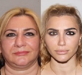 TURCI SU OVIM ZAHVATOM PRELAZIŠLI SAMI SEBE Sredovečnu ženu pretvorili u devojku, "komotno bi mogla da bude nova Hurem"