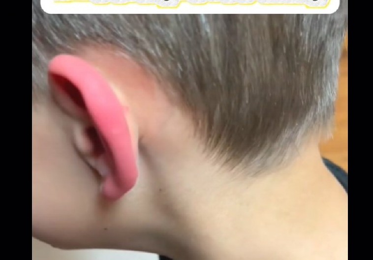 DEČAK JE JEO ROŠTILJ I DOBIO UŽASAN BOL U UHU Analize kod lekara su pokazale uzrok koji ledi krv u žilama!