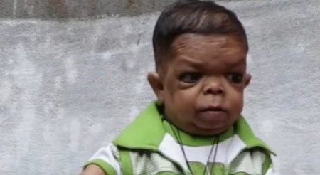 IMA 25 GODINA, A TELO DVOGODIŠNJAKA Evo kako izgleda jedan od najnižih ljudi na svetu, majka ga zbog bolesti nosi kao da je beba! (VIDEO)