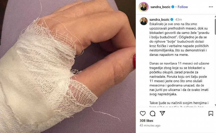 "POKUŠALA JE DA MI SLOMI RUKU" Sandra Božić objavila sliku povreda! "Najgnusnije me je vređala samo zato što sam u SNS-u!"