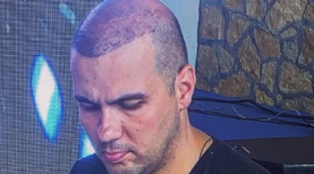 "JEO SAM OSTATKE TUĐIH SENDVIČA" Pevač otkrio kroz šta je prošao: "Od stresa mi je opala kosa"