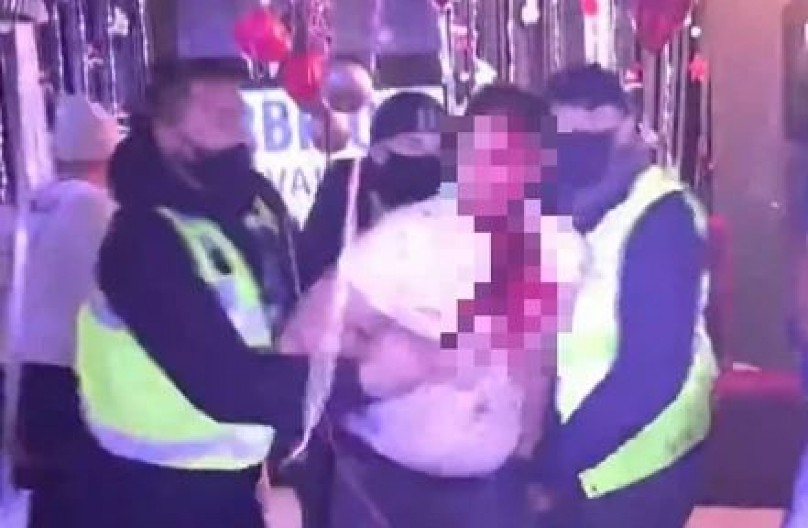 KRV LIJE NA SVE STRANE, JEZIVI PRIZORI! Ovo je najmonstruoznija scena u rijalitiju ikada!