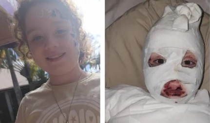 8-GODIŠNJAKINJA UMALO NASTRADALA: Temu povlači opasnu majicu iz prodaje