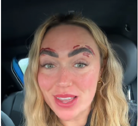 MARTINA PROKLINJE DAN KAD JE OTIŠLA NA DEPILACIJU OBRVA  "Spalila mi je lice, već danima ne mogu da dođem sebi!"