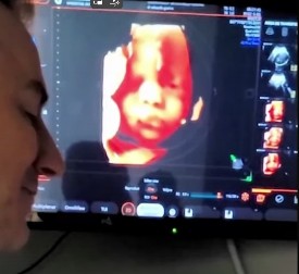 NESVAKIDAŠNJA SCENA NA ULTRAZVUKU Otac progovorio, a reakcija njegove ćerke u stomaku šokirala sve! (VIDEO)