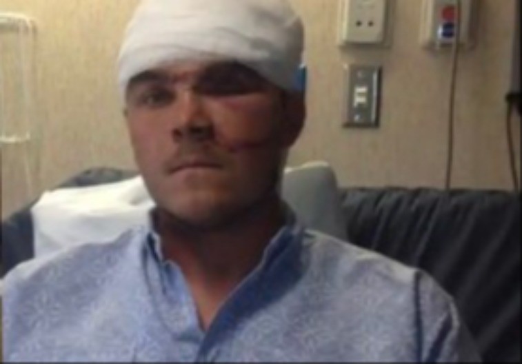 POMAHNITALA DIVLJA ZVER UGRIZLA LOVCA ZA GLAVU Spasio se tako što joj je GURNUO RUKU U GRLO!