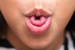 Možete li da savijete jezik u obliku slova ‘U’? Ovaj trik otkriva tajnu vašeg mozga – proverite da li spadate u genijalce!