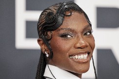 MA KAKAV BOTOKS I FILERI Pevačica zategla lice kao praćku uz pomoć jedne sitnice, Srpkinje odmah potrčale da i one probaju