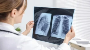 Bolest pluća ne počinje uvek kašljem: 4 rana simptoma koja mnogi zanemaruju