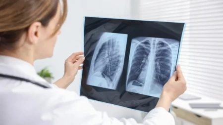 Bolest pluća ne počinje uvek kašljem: 4 rana simptoma koja mnogi zanemaruju