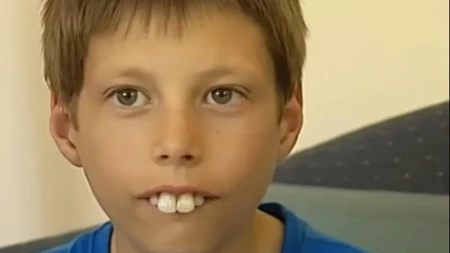 Zvali su ga „dečak zec“ i maltretirali ga zbog zuba! Kada su ljudi videli njegovu priču, usledio je preokret koji je rasplakao svet