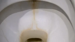 Evo kako moja snajka sklanja kamenac sa dna WC šolje za sekund