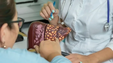 Ovu hranu voli jetra: Posebno je dobra ako je masna, može da pomogne kod steatoze