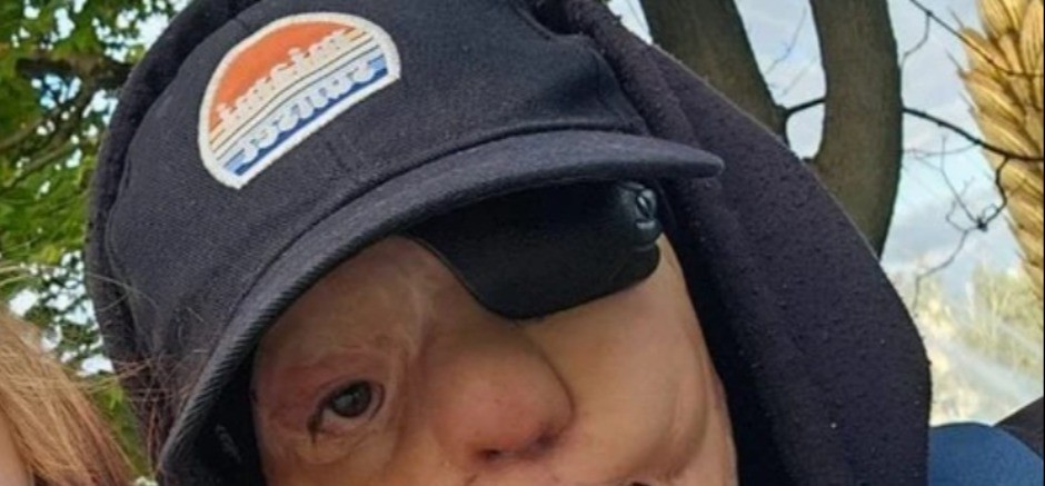 STAFORD MU JE POJEO LICE, A ŽIVOT MU SE PRETVORIO U PAKAO Igorova ispovest ledi krv, evo kako danas izgleda i živi!