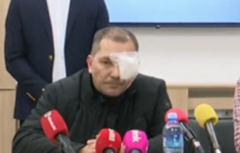 NAPADNUTI AKTIVISTA SNS: U šoku sam! Slomili su mi naočare, još me boli glava od udarca