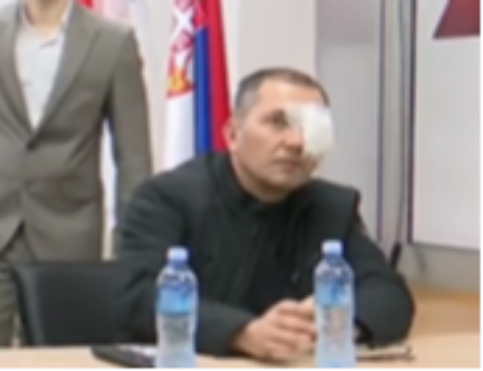 "MESECIMA SMO NA UDARU!" OO SNS o napadu na aktivistu