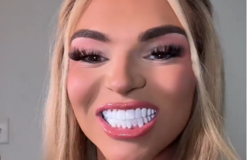 AU! Devojka nove zube platila kao GARSONJERU, ljudi na mrežama ZANEMELI kad su videli rezultat (VIDEO)