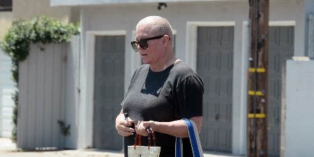 Nalazi su pokazali još jedan mogući rak: Nekad zanosnu plavušu teška bolest je potpuno promenila