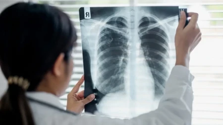 Ne ignorišite simptome: Kardiolozi otkrivaju kako da prepoznate krvni ugrušak pre nego što bude kasno