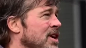 HOLIVUDSKOG LEPOTANA NIKO NE MOŽE DA PREPOZNA Natečen je, u modricama i zapušten - svi se pitaju šta mu se desilo