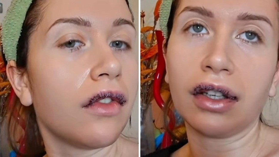 OPERISANA NAŠA PEVAČICA Otkriveno u kakvom je stanju: "Devojke, nemojte oklevati" 