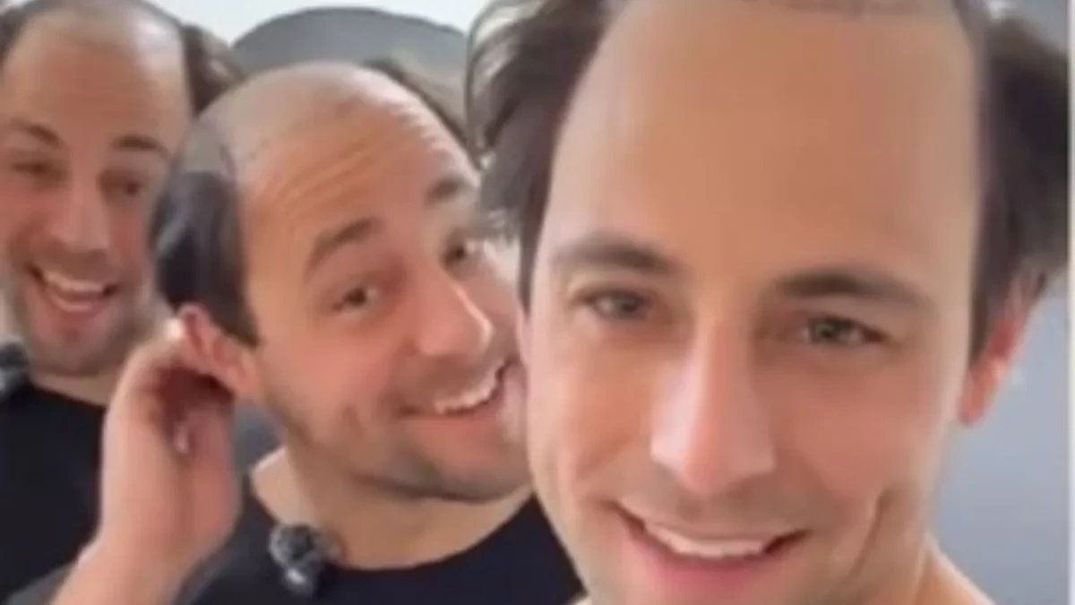 TROJKE IZAZVALE HAOS NA INTERNETU Otišli zajedno na transplantaciju kose – rezultat šokirao sve!