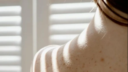 FLEKE U TRUDNOĆI Uzroci, vrste i načini zaštite