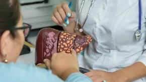 Nema bolje hrane za masnu jetru od ovde: Ovo su zlatne namirnice, preokrenu očas posla parametre u nalazima