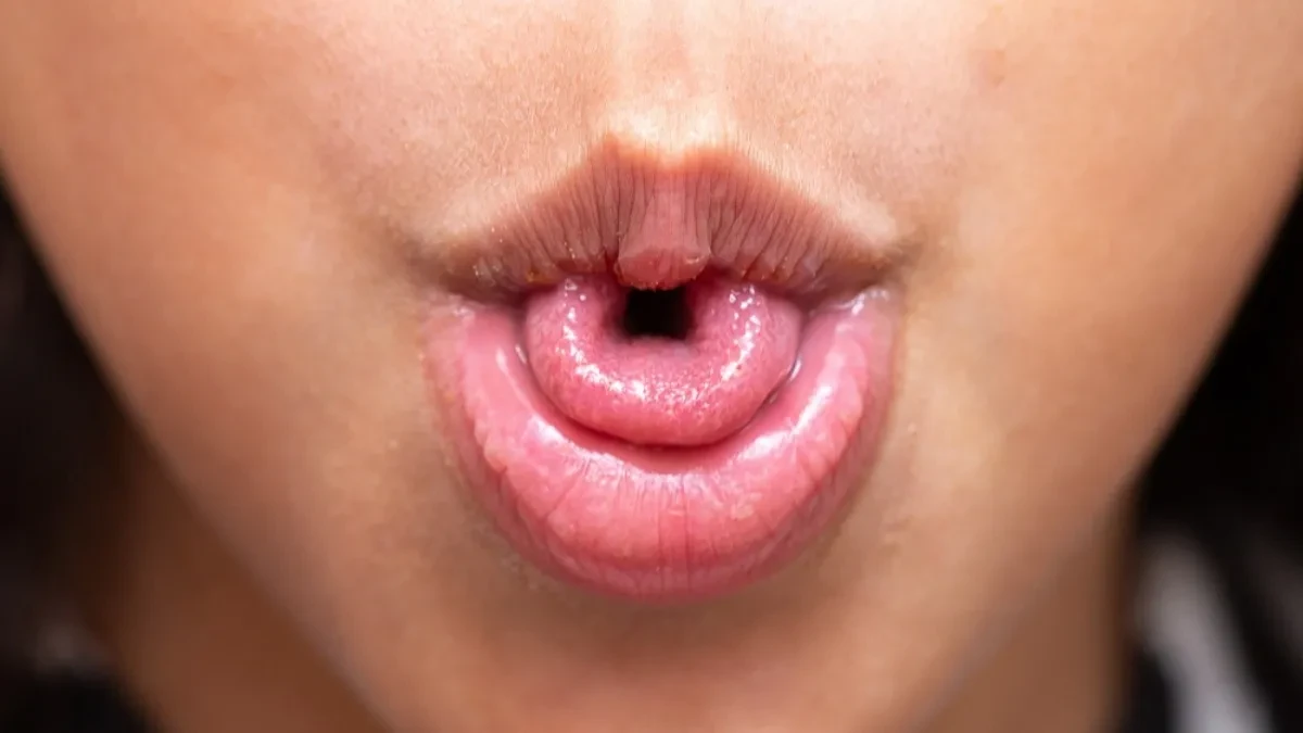 SAVIJANJE JEZIKA U OBLIKU SLOVA "U" NE MOŽE SVAKO Karakteristično je za određeni tip ljudi