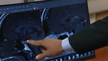 MISLILA DA JE DO STRESA Česti simptomi krili su opaku bolest, a ona kaže da je ovo bio najgori deo