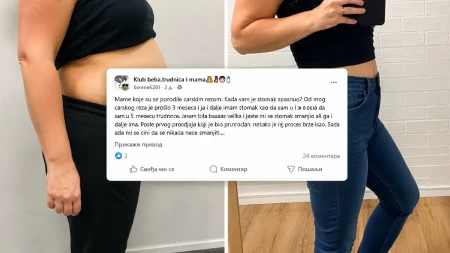 „Tri meseca posle carskog i dalje izgledam kao da sam trudna“ Jedna mama se požalila, sve posumnjale na istu stvar