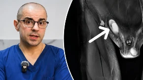 Nespušteni testis kod dece: Doktor Milivojević za Mame.rs otkriva kada je pravo vreme za pregled i lečenje?
