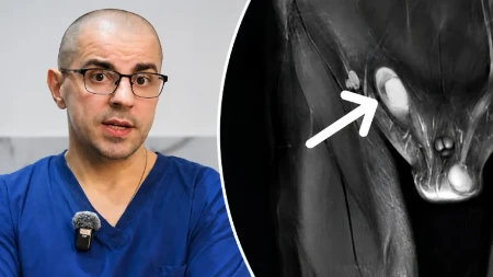 Nespušteni testis kod dece: Doktor Milivojević za Mame.rs otkriva kada je pravo vreme za pregled i lečenje?