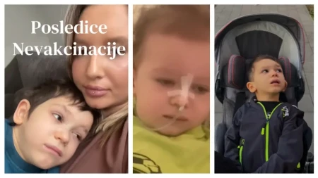 „Moj sin ne može da sedi, pomera vrat, zarazio se nevakcinisan“ Male boginje su Nemanji uništile detinjstvo