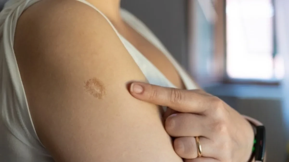 Internet ponovo priča o čuvenom ožiljku na nadlaktici: Njegova prava priča ledi krv u žilama