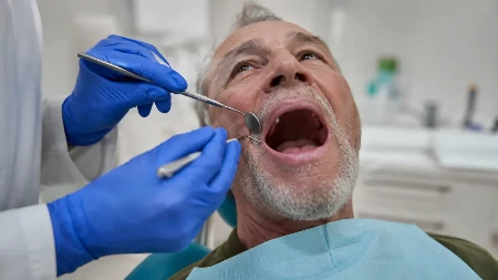 Srbija ostaje bez zuba! Čak 700.000 ljudi nema nijedan, doktori alarmiraju