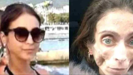 Htela da udovolji mužu, pa uništila sebi život: Jana je smršala na 22 kilograma, a on je na kraju ostavio