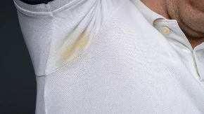 Muče vas žute fleke na belim košuljama? Rešenje već imate u fioci!