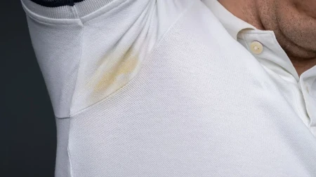 Muče vas žute fleke na belim košuljama? Rešenje već imate u fioci!