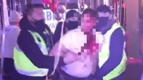 Krv lije na sve strane, jezivi prizori! Ovo je najmonstruoznija scena u rijalitiju ikada, od ovih kadrova se ledi krv u žilama!