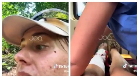 Turistkinju ujela najotrovnija zmija u Albaniji: Snimljeno kako se bore da je spasu
