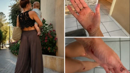 „U njima sam zamalo pala sa bebom u rukama“ Žene pokazuju povrede zbog viralnih šalvara