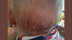 „Bebi se stalno prave čvorići u kosi“ Mama pitala kako da ih ukloni, roditelji otkrili uzrok
